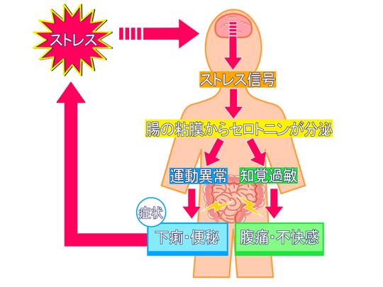 過敏性腸症候群について - 京都市・桂駅近くの鍼灸院 鍼灸院