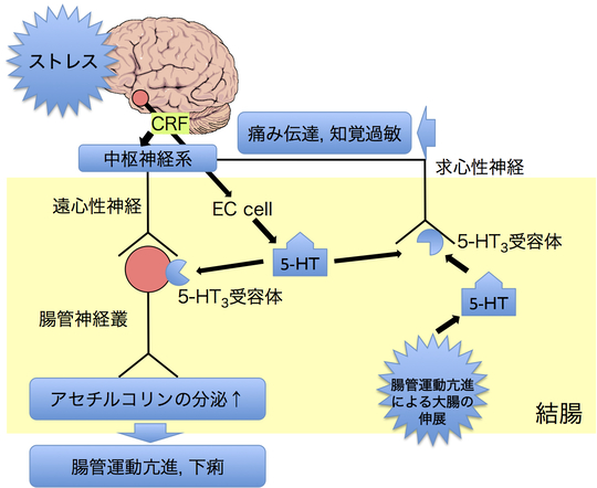 過敏性腸症候群について - 京都市・桂駅近くの鍼灸院 鍼灸院
